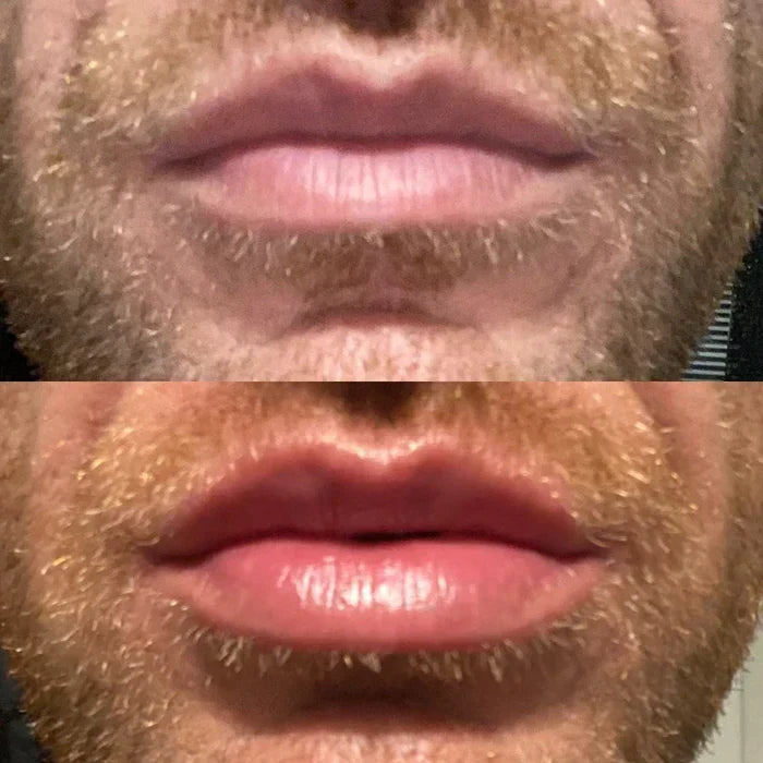 Rapid Lip Plumping Serum