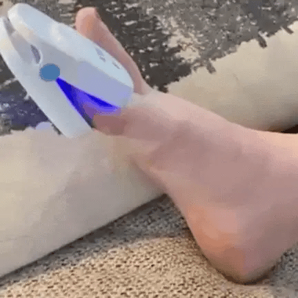 At-Home Laser Device for Toenail Fungus Treatment