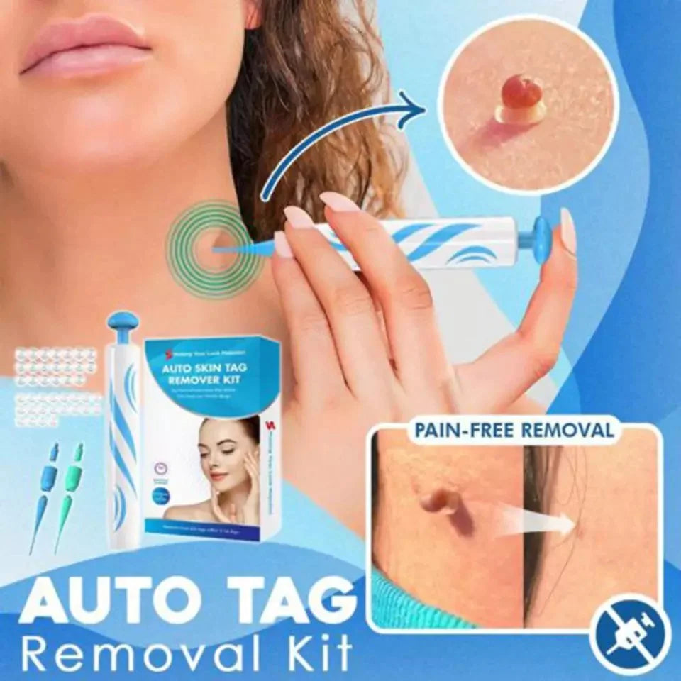 Skin Tag Removal Kit - Effortlessly Eliminate Skin Tags