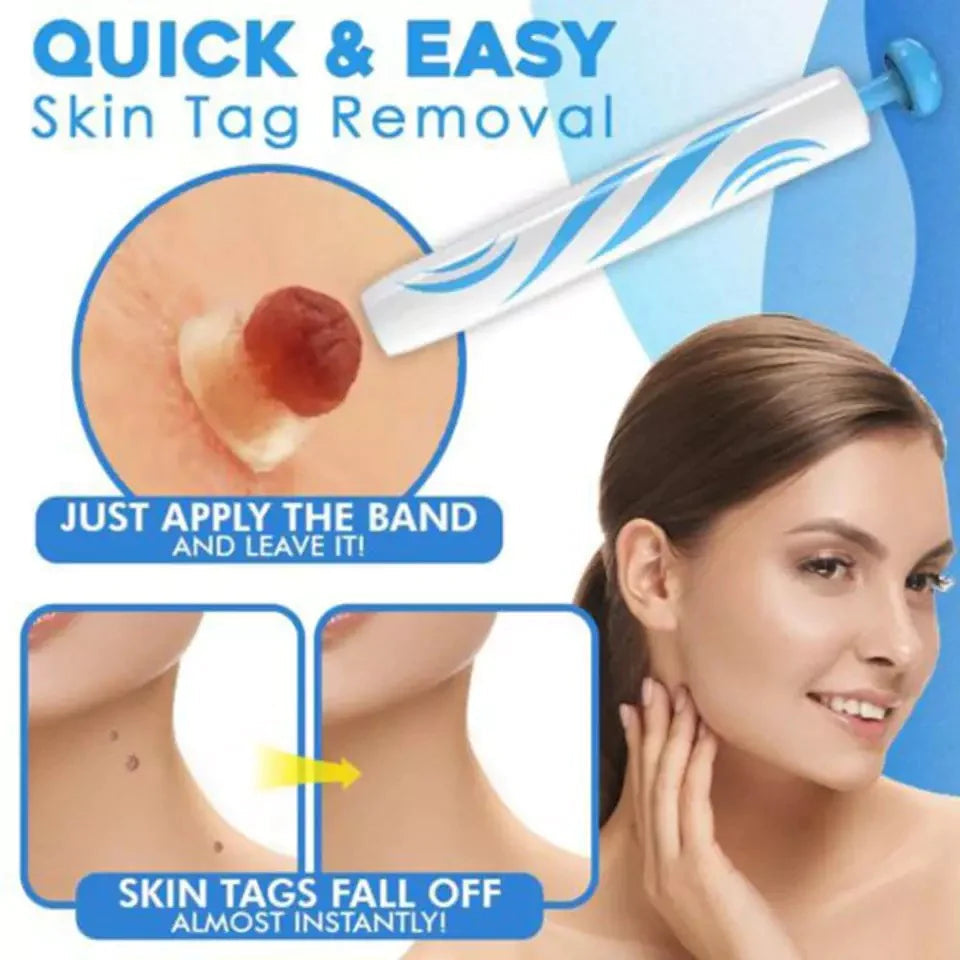 Skin Tag Removal Kit - Effortlessly Eliminate Skin Tags