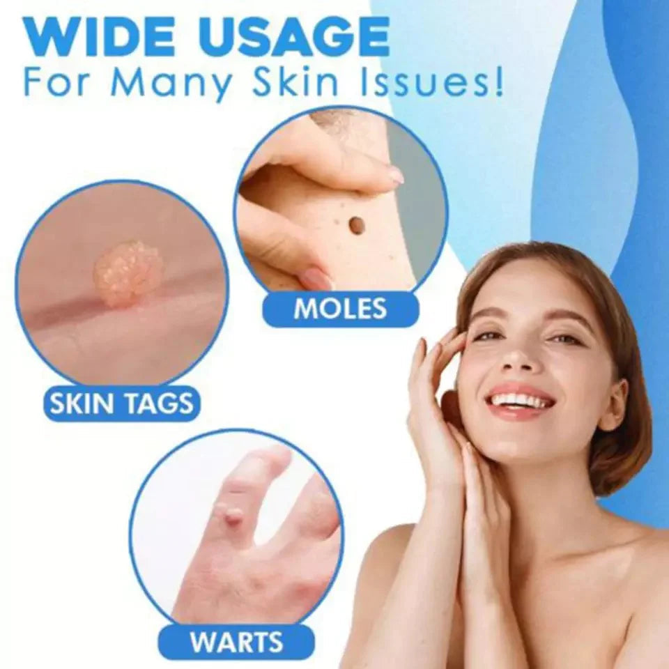 Skin Tag Removal Kit - Effortlessly Eliminate Skin Tags
